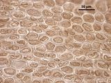4 - Cellule corticali in visione superficiale